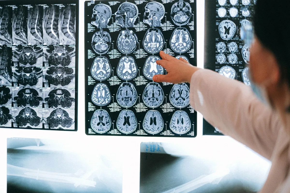Ozempic's Brain Breakthrough: Unlocking Your Hidden Craving Center