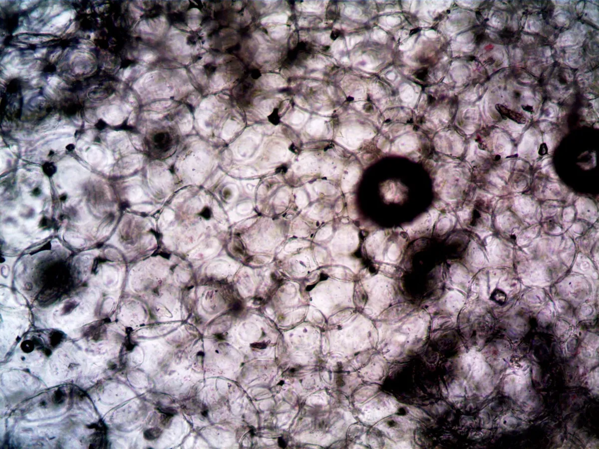 Scientist analyzing cellular structures related to fat and muscle.